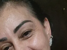 Photo de la webcam 3