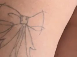 Photo de la webcam 1