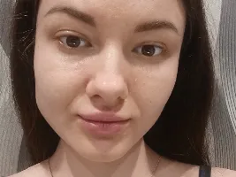 Photo de la webcam 3