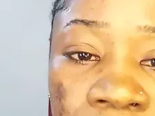 Oma 3